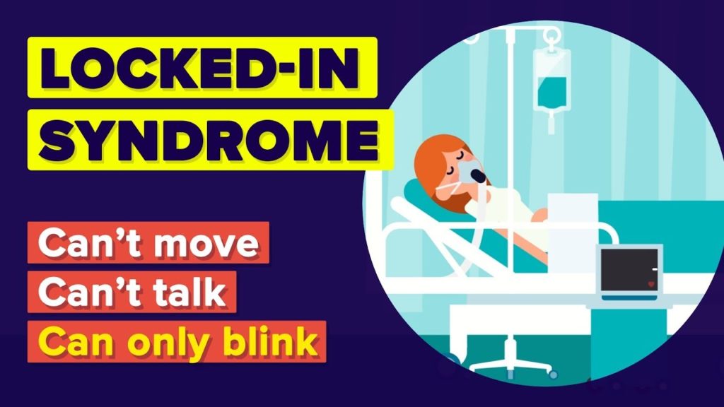 Video Infographic What Is Lockedin Syndrome? Worst Thing That Can