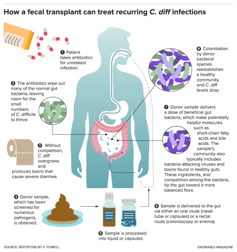 Chart Infographic How Fecal Transplants Work Against Recurrent C Diff Infections 4176