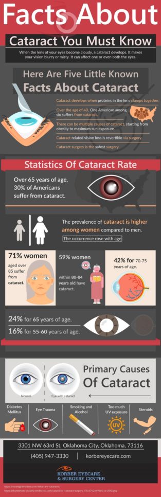 Infographic : Facts About Cataract You Must Know – Infographic.tv ...