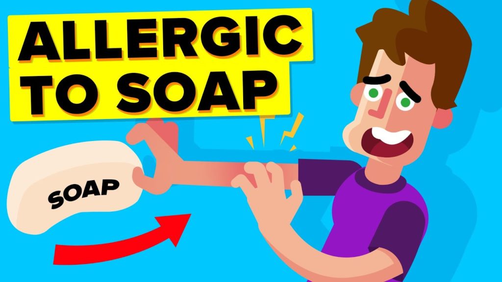 Video Infographic I Am Allergic To Soap (Story) Infographic.tv