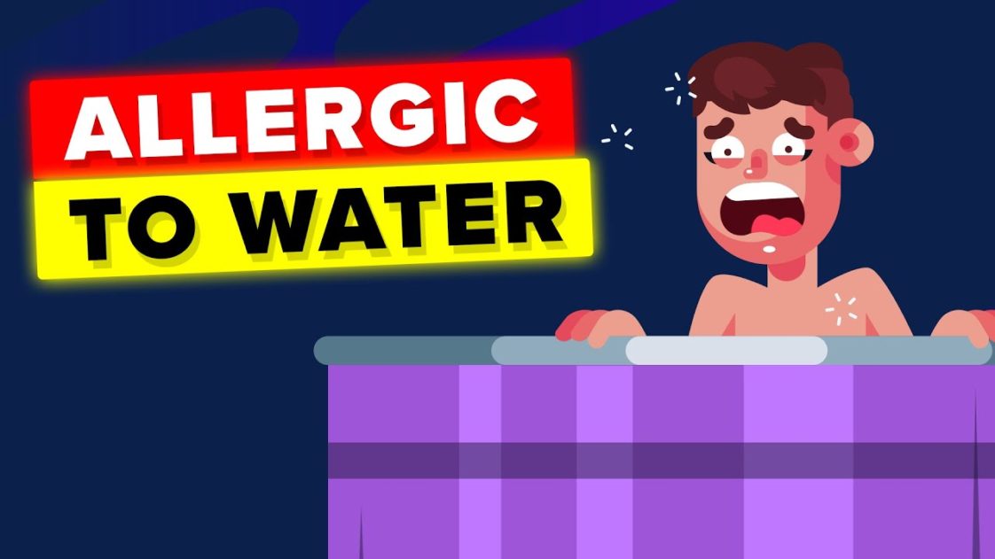 Video Infographic Woman Allergic to Water, This is How She Lives